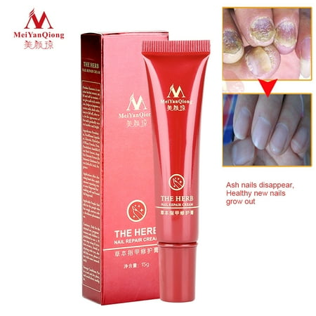 WALFRONT Nail Treatment Cream Fungus Removal Cream Herbal Deep Sterilization Natural Nail Care Cream