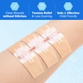 lotfancy-4-pack-zip-stitch-sutures-emergency-surgical-wound-closure