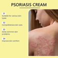 thumbnail image 4 of Psoriasis & Eczema Relief Cream Anti-Itch, Soothing & Moisturizing with Allantoin & Natural Extracts for Sensitive Skin, 4 of 5