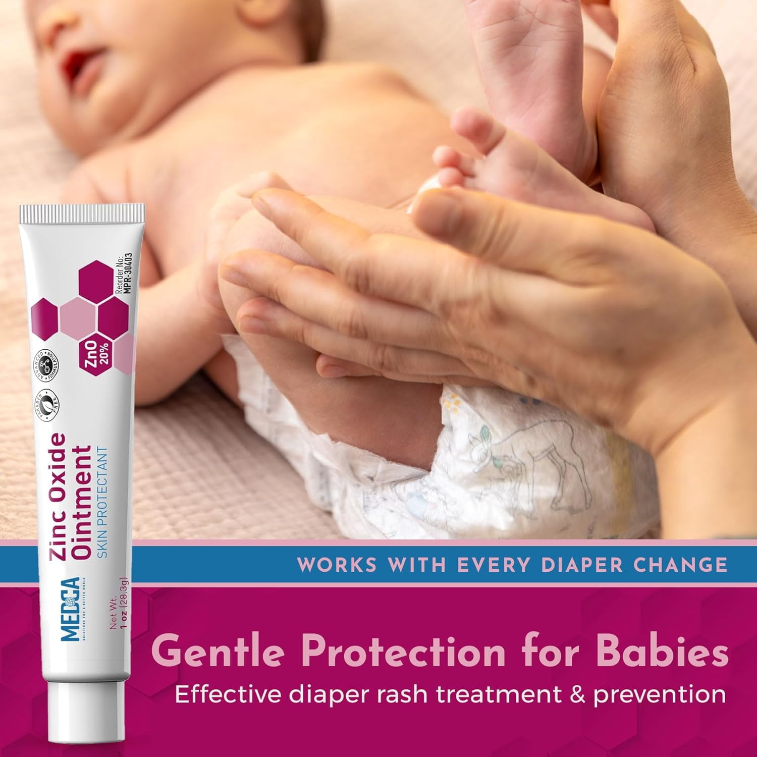 MEDca High-Potency 20% Zinc Oxide Ointment - Baby Diaper Rash Cream (Pack of 24, 1oz Tubes), Soothing, Hypoallergenic, Gentle Skin Protectant for Chafed Skin, Wetness & Overnight Protection, All Ages