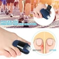 thumbnail image 4 of Trianu 4 Pack Toe Splint, Toe Straightener for Hammer Toe, Bent Toe, Claw Toe, Crooked Toe, Toe Wrap to Align and Support Toe - Beige, 4 of 8