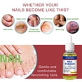 thumbnail image 4 of 3pcs Anti Fungal Treatment Fungus Effective Finger Toe Nail Repair Liquid Solution, 4 of 5