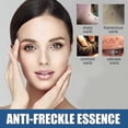 thumbnail image 2 of Skin Cleansing Gram Wart Keyou Liquid Body Facial Fleshy Neck Silky Smooth Wart Care, 2 of 3
