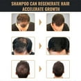thumbnail image 4 of 1/3/5x Spartan Shampoo, Spartan Root Activator Shampoo, Mane Root Activator Shampoo, 4 of 5