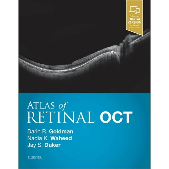 Atlas of Retinal Oct: Optical Coherence Tomography (Hardcover)
