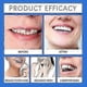 thumbnail image 5 of Silicone Reline Denture Set, Denture Silicone Reline Kit for Dentures, Soft Denture Reline Kit for Men and Women, Unisex Denture Reline Kit is Suitabl, 5 of 5