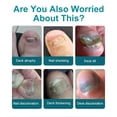 thumbnail image 2 of Tratamiento reparador de uñas Anisx multiusos de 30 ml con tolnaftato, 2 of 7