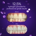 Whitening Teeth At Home: Burst Strips Guide - 3atp34j