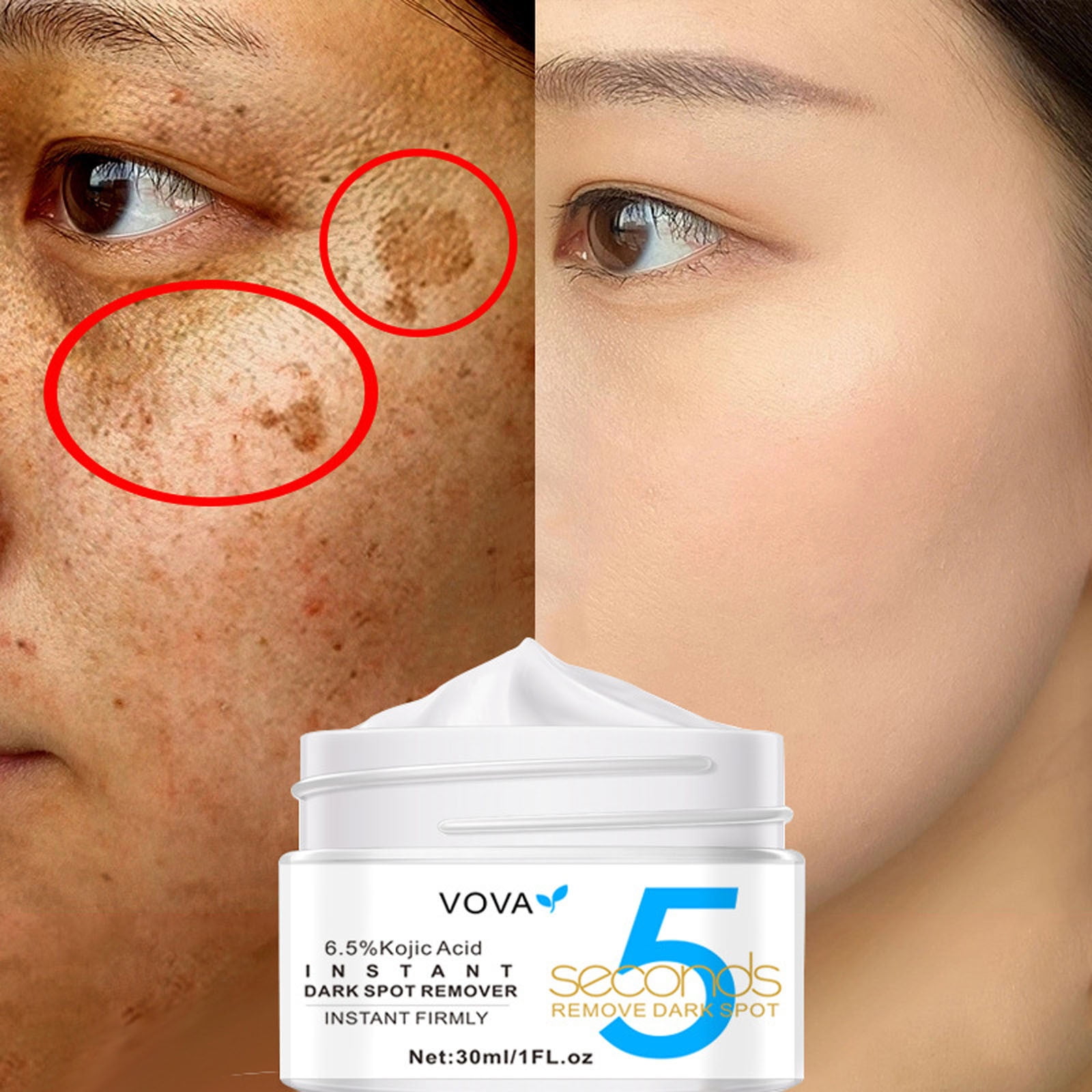 Yayiaclooher 6.5% Kojic Dark Remove Face Cream Dark Remover For Facial ...
