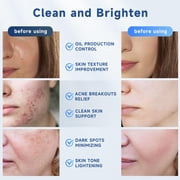Glycolic Acid Pads, Exfoliating Resurfacing Pads for Face with Salicylic Acid Pad with Tea Tree Oil, Exfoliating Face Peel & Radiance Deep Cleaning Effect, Dark Spot Removers 60 Count