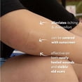 thumbnail image 3 of Scar Away Medical-Grade Clear Silicone Scar Sheets 6 Sheets, 3 of 5