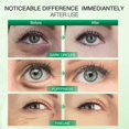 thumbnail image 3 of 1pc Matcha Eye Mask, Home Spa Skin Care Collagen Aloe Vera Reduce Dark Circles, 3 of 4