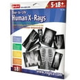 thumbnail image 2 of True To Life Human X-Ray Set, Pack Of 18, 2 of 2