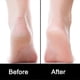 thumbnail image 5 of Foot Files, Foot File Foot Pedicure Kit, Stainless Steel Foot Files,Stainless Steel File, Foot File Foot Care Pedicure Tool for Both Wet and Dry Crack, 5 of 5