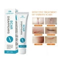 thumbnail image 3 of Clearance! 20g Scar Removal Cream Repairing Burn Scratch Pimples Skin For All Scar√ A4C0, 3 of 8