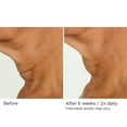 thumbnail image 3 of Deco-Lift Neck  Decollete Firming  Lifting Complex 1.7 oz, 3 of 8