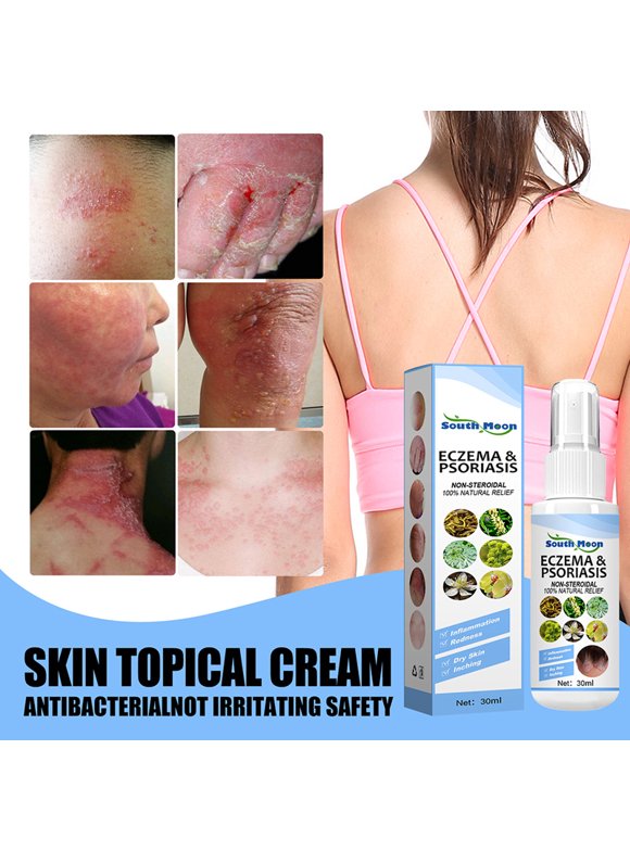 Ringworm in First Aid