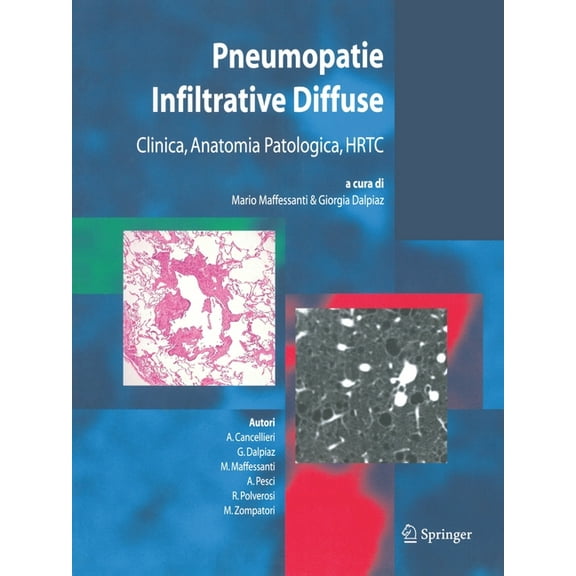 Pneumopatie Infiltrative Diffuse: Clinica, Anatomia Patologica, Hrtc, (Paperback)