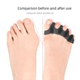 thumbnail image 4 of Big toe orthotics, overlapping toes, forked toes, thumb care orthotics, forked toes, toe protection covers, 4 of 5