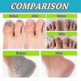 thumbnail image 4 of 3pcs Pro Foot And Spary, And Power, 4 of 5