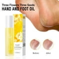 thumbnail image 1 of Pisexur Belleza Maquillaje Aceite de manos y pies Three Flowers: repara las manos y los pies agrietados, secos y con picazón, hidratando 8 mlpara mujeres y hombres, 1 of 9