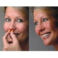 thumbnail image 1 of 3pcs Anti Snoring Nasal Dilator Transparent - Nose Breathing Middle - Nasal Congestion Prevention, 1 of 3