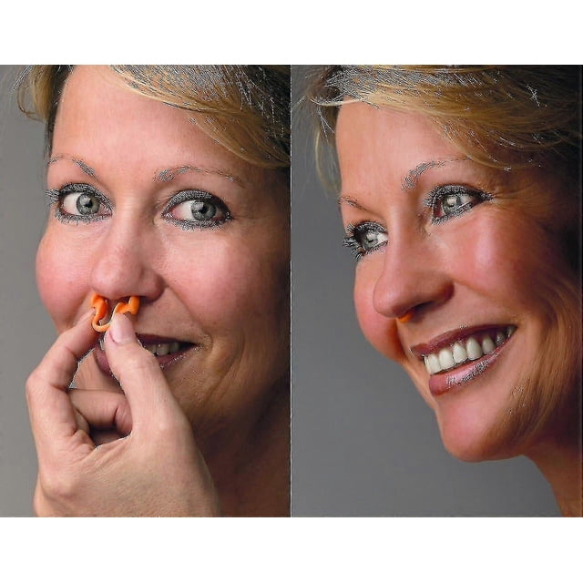 3pcs Anti Snoring Nasal Dilator Transparent - Nose Breathing Middle - Nasal Congestion Prevention