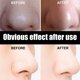 thumbnail image 3 of Vogacara Limpieza facial, carbón de bambú, removedor de espinillas y acné, limpieza corporal suave, cuidado de la piel portátil, belleza Tratamientos faciales, 3 of 6