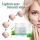 thumbnail image 3 of EELHOE Crema EELHOE de 30ML para cicatrices y manchas, con extractos naturales que suavizan y aclaran la piel de manera efectiva., 3 of 6