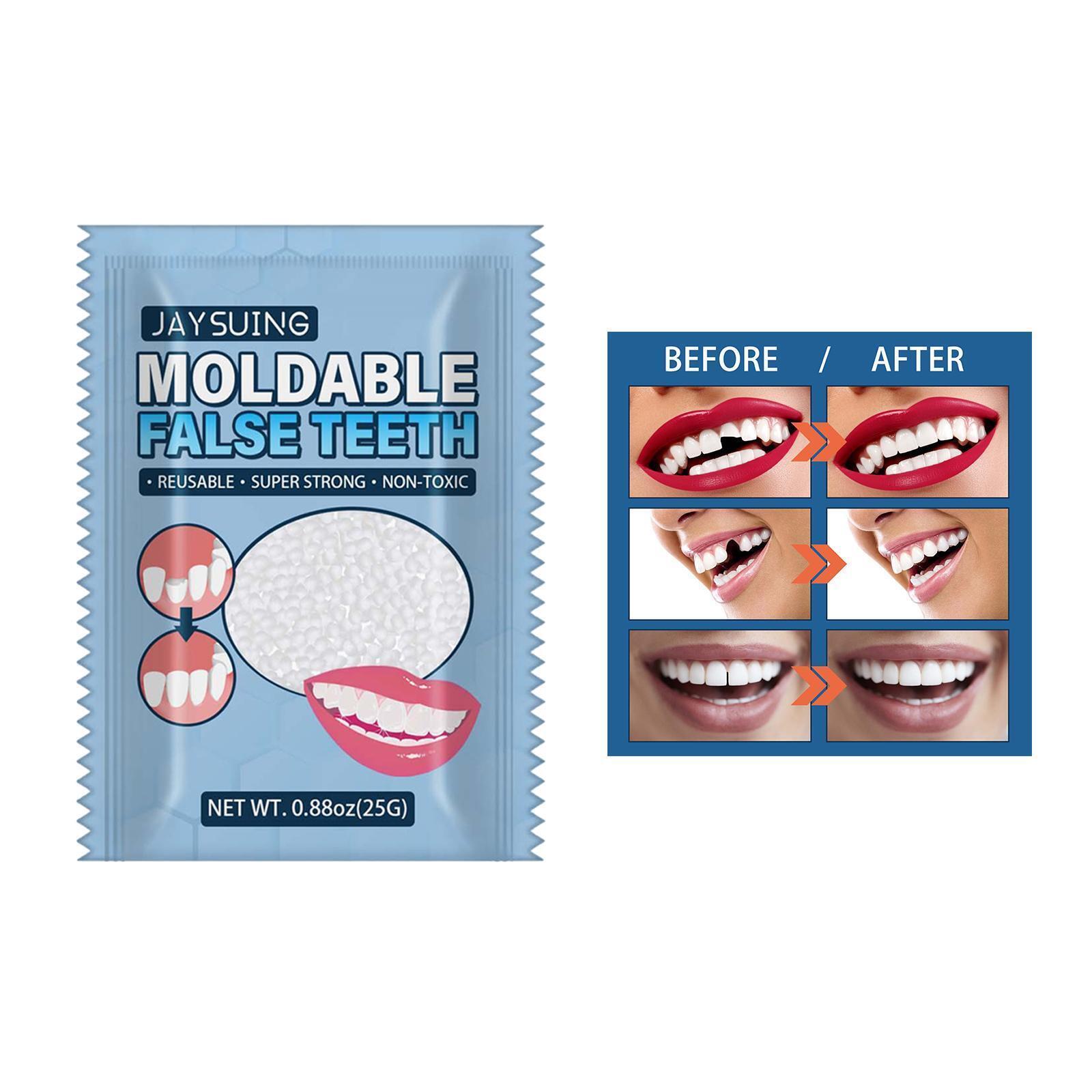 25G Temporary Tooth Repair Kit Solid Glue For Teeth Veneer Whitening