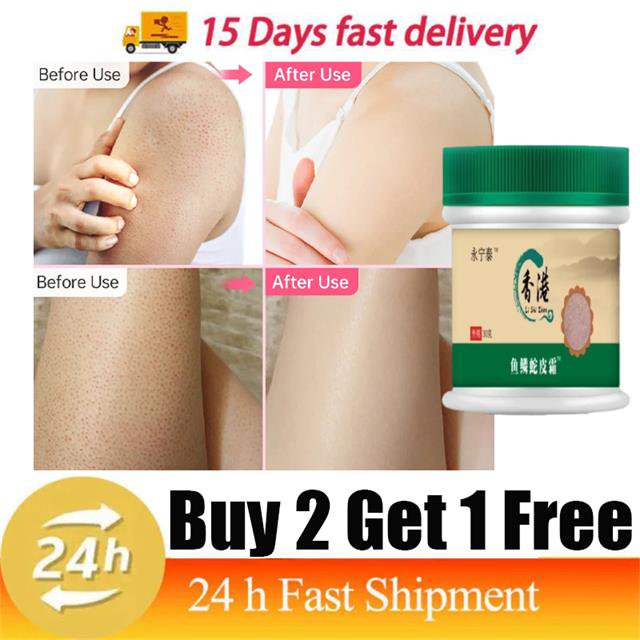 Crema reparadora de piel de pollo, loción de suero suave hidratante, elimina los poros gruesos, elimina las manchas oscuras del cuerpo, queratosis, folículo Pilaris