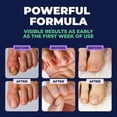 thumbnail image 5 of Tratamientos para hongos en las uñas de los pies: Lápiz extrafuerte para uñas de los pies y de las manos. Tratamientos para hongos en las uñas para un crecimiento más saludable., 5 of 5