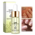 CENGZISHU Rich Vitamin Nail Strengthening Cuticle Oil Nail Growth And