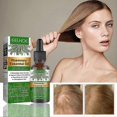 thumbnail image 3 of Aceite esencial de romero 3 uds yuxing Tratamiento cuidado piel crecimiento cabello 100% natural, 3 of 4