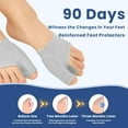 thumbnail image 2 of Peak Bunion Corrector - Alleviates Foot Pressure, Comfortable Day & Night, 2 Pair for Women & Men, 2 of 7