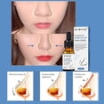 thumbnail image 4 of Fiudx Aceite Nose Up, Hidratante Nasal a Base de Hierbas, para El Desarrollo Del Cartílago Nasal, Gotas para Moldear La Nariz, para Todo Tipo de Piel, Solo para Uso Externo, Frasco de 10 Ml, 4 of 6