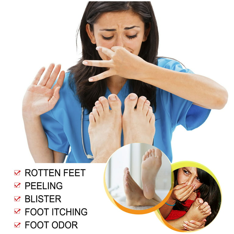 Mightlink 20g/30ml Athlete Foot Spray Anti-Fungal Relief Foot Disease Skin  Care Toe Treatment Foot-repair Foot-care Antibacterial Reduce Itching Foot  Foot Cream 