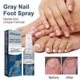thumbnail image 1 of South moon onychomycosis repair spray moisturizes and cleans odor onychomycosis soft nail dry na, 1 of 5