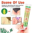 thumbnail image 1 of Crema para eliminar ácaros de 20g, no picante, antipicazón, uso externo, ungüento para sarna, piojos púbicos, piel, eccema, Dermatitis, yeso para adultos Vhermosa MGL-CC011, 1 of 5