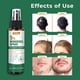 thumbnail image 2 of Spray para el crecimiento del cabello Pugbey con 5% de minoxidil para hombres y mujeres, 2 of 7