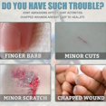 thumbnail image 5 of 1pcs Medical Glue For Cuts, Fast-drying & Breathable Liquid Skin Bandage, Great For Use On Fingers, 5 of 5