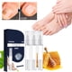 thumbnail image 3 of Lápiz reparador de uñas Essence Toenail Extra Strength para uñas dañadas, amarillentas, descoloridas, gruesas y encarnadas. Lápiz para uñas de pies y manos con 3 lápices de 12 ml., 3 of 9