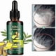 thumbnail image 1 of Ginger Hair Care Hair Loss 7 Day Improves Scalp Environment Anti-, 1 of 5