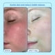 thumbnail image 4 of Aceite espumoso Cleanser Skinfix Barrier+ 180 ml, 4 of 8