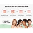 thumbnail image 6 of Acne pimple patch Skin care facial Hydrocolloid acne absorbing cover patches cute heart fashion, Blemish Spot, Skin Treatment, Facial Stickers 36pc, 6 of 7