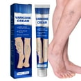 thumbnail image 1 of Crema para venas varicosas, 20g, crema de masaje de plantas naturales para eliminar varices y arañas vasculares, mejora la circulación sanguínea, 1 of 8