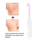 thumbnail image 3 of Máquina facial de alta frecuencia, mango de luz púrpura para apretar el acné y las arrugas, varita reductora 4 en 1 dispositivo de belleza para la piel de la cara Protección de La Piel Octpeak  NO, 3 of 7
