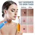 thumbnail image 4 of Skin-Tag Remover Double Headed Pen Set, Multi-Purpose 2 in 1 Design, Fast Effective Portable Convenient 2-9mm, 4 of 5