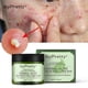 thumbnail image 3 of Joypretty Tea Tree Acne Cream Fades Acne Print Herbal Acne Cream, 3 of 4