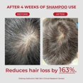 thumbnail image 5 of Set de champú y acondicionador para el crecimiento del cabello con biotina, fórmula coreana sin parabenos para todo tipo de cabello., 5 of 5